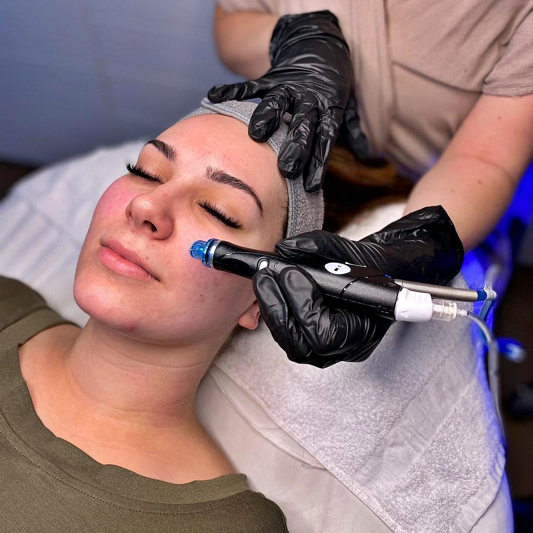HydraFacial